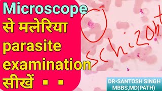 Examine Malaria Parasite Under microscopic  मलेरिया स्लाइड टेस्ट  PVivex  PFr  Ring Form [upl. by Nonie210]