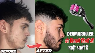 dermaroller से कितने दिनों में दाढ़ी आती है  कब यूज करें  Derma roller for beard growth  beard [upl. by Cotsen]