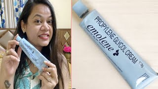 बहुत सारे Moisturiser Use किए कोई अच्छा Moisturiser नहीं मिला Try Emolene Cream [upl. by Ahrens]