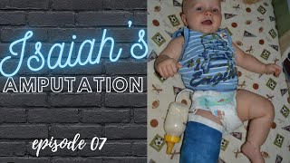 Isaiahs Amputation Story The Climb EP 07 [upl. by Eanwahs]