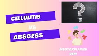 Cellulitis vs Abscess [upl. by Margherita642]