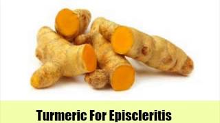 9 Top Natural Cures For Episcleritis [upl. by Ikkir]