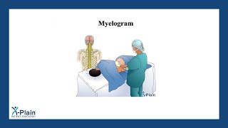 Myelogram [upl. by Gertrud]