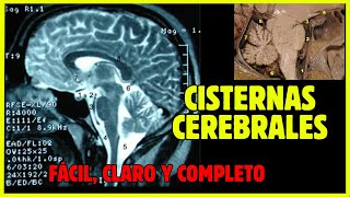 🧠 CISTERNAS CEREBRALES  Anatomía de las cisternas subaracnoideas fácil y completo [upl. by Clarke]