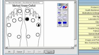 Image Template for SemmesWeinstein monofilament exam [upl. by Wiatt]