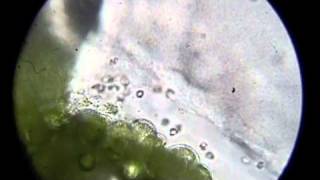 Ceratopteris gametophytes and sperm [upl. by Borszcz192]