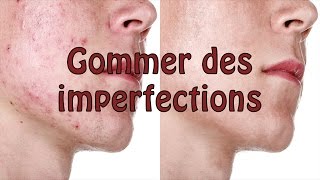 PHOTOSHOP Tutoriel  Gommer des imperfections acné etc dun visage [upl. by Sedgewick]