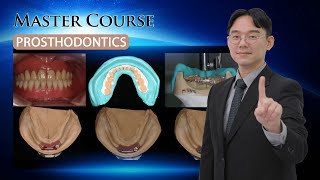 Master Course  PROSTHODONTICS Occlusal scheme of implant prosthesis [upl. by Erusaert685]